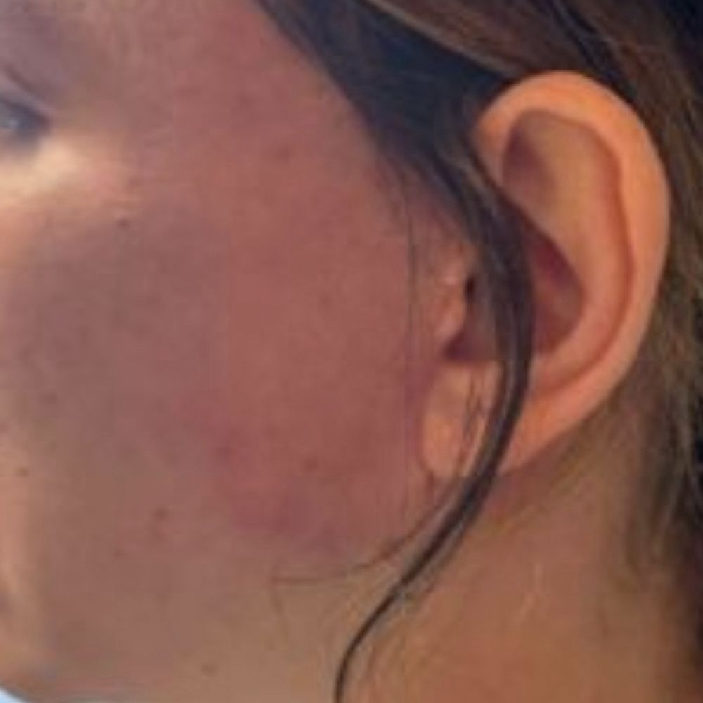 David L Abramson,MD - Skin tightness - Cosmetic Surgeons Near Me - Englewood, New Jersey David L Abramson,MD - Skin tightness - Cosmetic Surgeons Near Me - Englewood, New Jersey