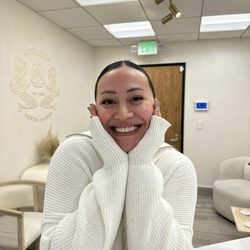Argina Kudaverdian - 32ology Dental Studio - Smile Makeover - Porcelain Veneers