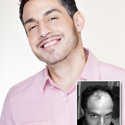 MHN Hair Restoration Studio - Life changing work!