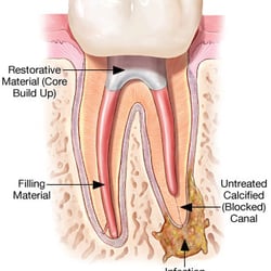 Scarsdale Endodontics
