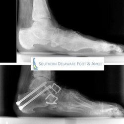Southern Delaware Foot & Ankle