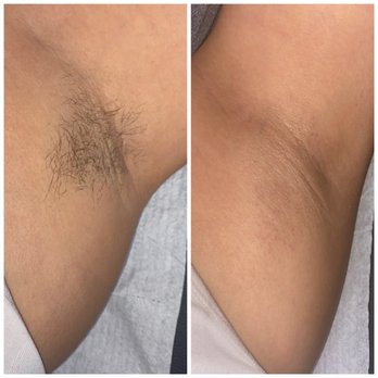 KSalonStudio - Underarm Waxing - Waxing Near Me - Tucson, Arizona KSalonStudio - Underarm Waxing - Waxing Near Me - Tucson, Arizona