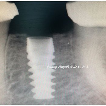 Quang Huynh, DDS, MS - Periodontists Near Me - Milpitas, California Quang Huynh, DDS, MS - Periodontists Near Me - Milpitas, California
