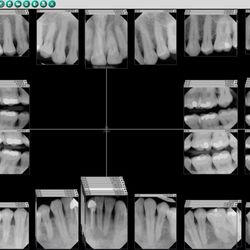 Smile Station Dental - Our digital X-ray system allows us to take crystal clear images of your teeth and oral structures with low radiation levels.