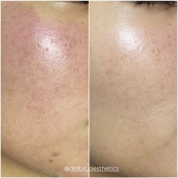 Dalbit Aesthetics - Skin Care Near Me - Alhambra, California