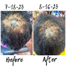 The J.Sarne Experience - Hair & Scalp on the road to healing