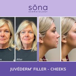 Sona Dermatology of Lake Norman
