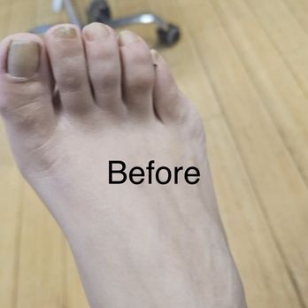 Ca Nail Bliss - Before steamed pedicure - Nail Salons Near Me - Downey, California Ca Nail Bliss - Before steamed pedicure - Nail Salons Near Me - Downey, California