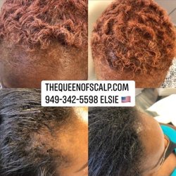 SMP Hair Clinic The Queen Of Scalp