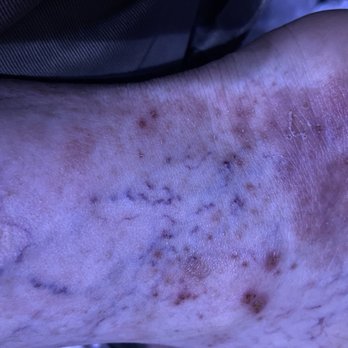 My Self Storage Space - Injuries of mold poising and not having accommodations in the dark. - Self Storage Near Me - Camarillo, California