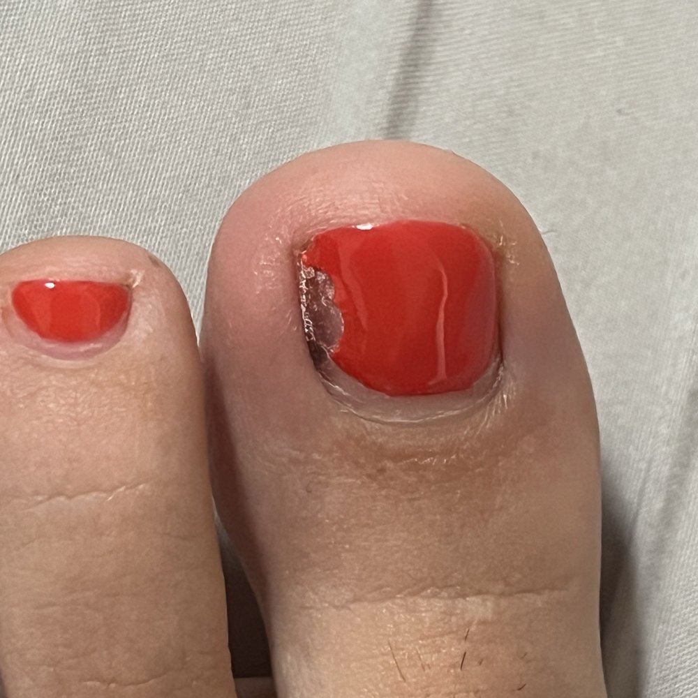 Nail SPY - My toe nail is BLACK - Nail Salons Near Me - New York, New York Nail SPY - My toe nail is BLACK - Nail Salons Near Me - New York, New York