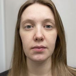 Revive Aesthetics & Wellness Center - My skin now, no makeup! Love facials from Ashley.