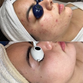 Complexions Skincare & Body - Skin Journey - Skin Care Near Me - Salinas, California Complexions Skincare & Body - Skin Journey - Skin Care Near Me - Salinas, California