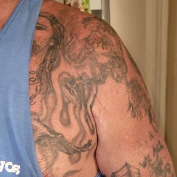 Christopher Woodson, MD - Shoulder Replacement - Orthopedists Near Me - Los Alamitos, California Christopher Woodson, MD - Shoulder Replacement - Orthopedists Near Me - Los Alamitos, California