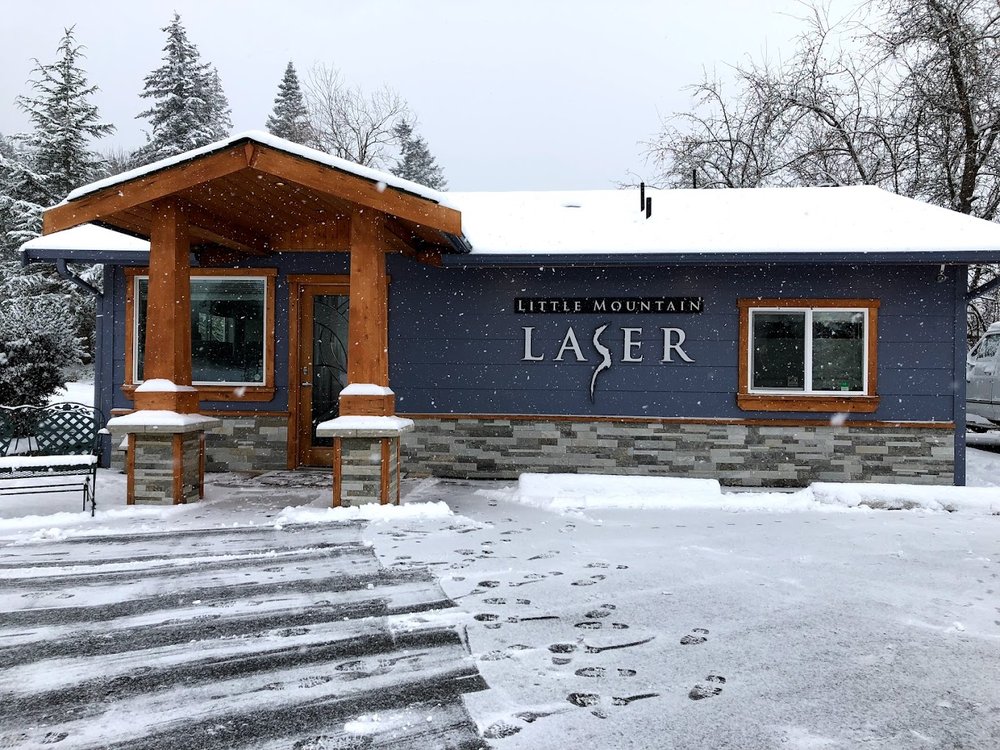 Little Mountain Laser Logo