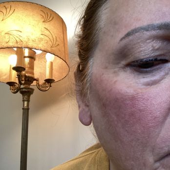 ReJuvenere Medical Spa - Medical Spas Near Me - Lockport, New York ReJuvenere Medical Spa - Medical Spas Near Me - Lockport, New York