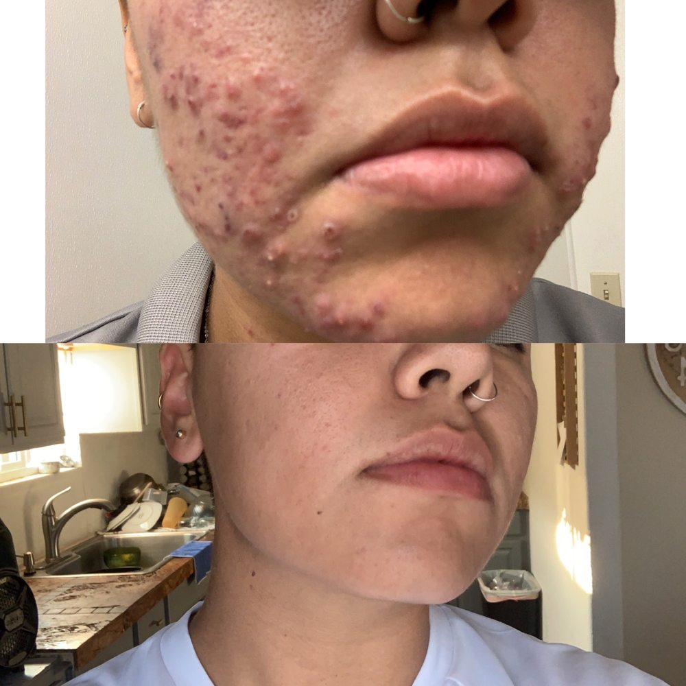 Before and After Before and After