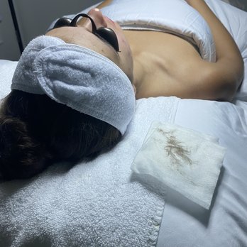 SKINDEEPRx - Customized facial with Dermaplaning - Acne Treatment Near Me SKINDEEPRx - Customized facial with Dermaplaning - Acne Treatment Near Me