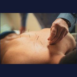 Open Valley Acupuncture & Massage
