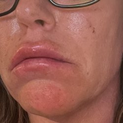 InnerBeauty Med Spa & Laser - Day 1.