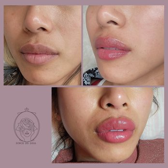 All About Beauty - no color on lips? Lip Blushing would be the answer! - Sugaring Near Me All About Beauty - no color on lips? Lip Blushing would be the answer! - Sugaring Near Me