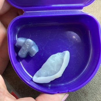Bridge Dental - Broken night guard I paid 100$ for. Was told they would not fix it but charge me another 100 for a new one. - General Dentistry Near Me - Charleston, South Carolina