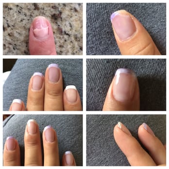 Forever Nails & Spa - Got " hard gel fill" done on a Tuesday and by Thursday they started staining and day Sunday they were chipping off.Poor job done - Skin Care Near Me - Valencia, California