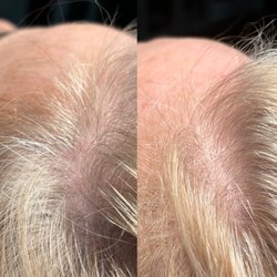 CK Hair Solution - Filling in those sides is a speciality we offer.