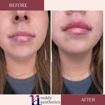 Reddy Aesthetics - Medical Spas Near Me - Paramount, California Reddy Aesthetics - Medical Spas Near Me - Paramount, California
