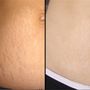 PermanentMakeup4U Clinic