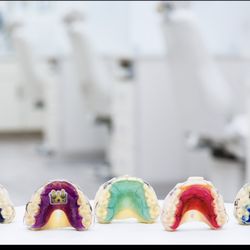 Bella Smile - Kids Hawley Retainers