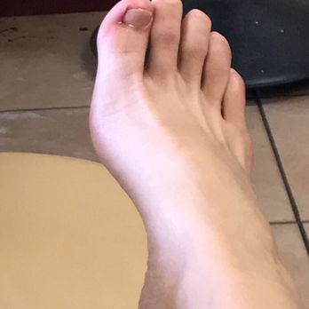 La Vie Nails - My foot after he dug it up. - Nail Salons Near Me - Alameda, California La Vie Nails - My foot after he dug it up. - Nail Salons Near Me - Alameda, California