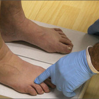Square One Physiotherapy - Custom Orthotics - Physical Therapy Near Me - Mississauga, Ontario Square One Physiotherapy - Custom Orthotics - Physical Therapy Near Me - Mississauga, Ontario