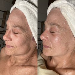 Emerald Esthetic - Firming Peptide Facial