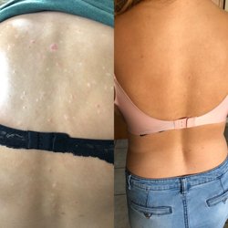 Wholistic Medical Group - On medication vs 3 months with Dr.Duke!