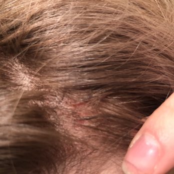 Salon O - Without flash burns and melted hair 2 - Hair Extensions Near Me - Murrieta, California Salon O - Without flash burns and melted hair 2 - Hair Extensions Near Me - Murrieta, California