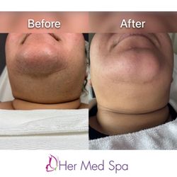Her Med Spa