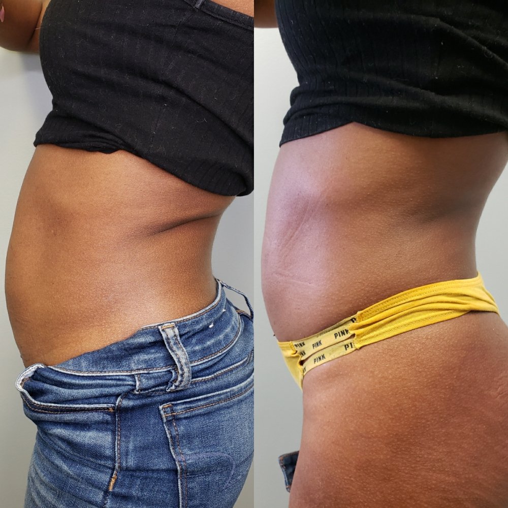 LA CURVES BODY CONTOURING Request Information 6977 Nexus Ct