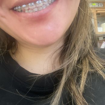 Upright Orthodontics - Orthodontists Near Me - La Mirada, California
