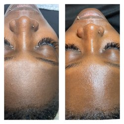 MBS Esthetics - Basic facial