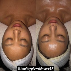 HealthyGlow By Lima - HealthyGlow Signature customized facial