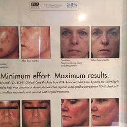 Marie Dawson - Skin disorder