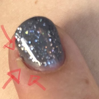 Allure Nails - Infected green cuticle the next day. - Nail Salons Near Me - Las Vegas, Nevada
