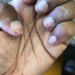 Perfect Nails