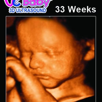 UC Baby Cambridge - Diagnostic Imaging Near Me - Cambridge, Ontario UC Baby Cambridge - Diagnostic Imaging Near Me - Cambridge, Ontario