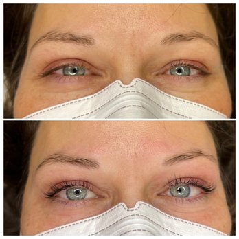 Sadowski Aesthetics & Laser - Lash lift and tint - Laser Hair Removal Near Me - Seattle, Washington Sadowski Aesthetics & Laser - Lash lift and tint - Laser Hair Removal Near Me - Seattle, Washington