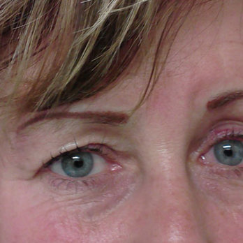 Electrolysis and Permanent Make-Up by Deborah R.E - Permanent Eyebrows - Hair Removal Near Me - El Cajon, California Electrolysis and Permanent Make-Up by Deborah R.E - Permanent Eyebrows - Hair Removal Near Me - El Cajon, California