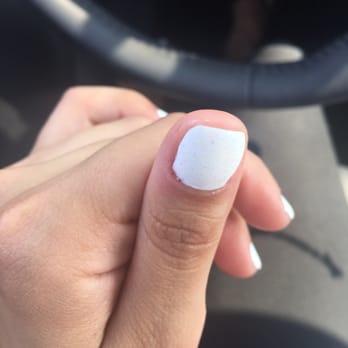 Amazing Nails & Spa - Took about 15 minutes for the cut to stop bleeding on the edge of thumb cuticle. - Nail Salons Near Me - Turlock, California Amazing Nails & Spa - Took about 15 minutes for the cut to stop bleeding on the edge of thumb cuticle. - Nail Salons Near Me - Turlock, California