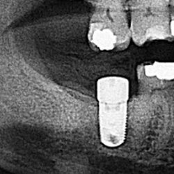 Walter C Jackson, DDS MD - Jackson Oral Surgery