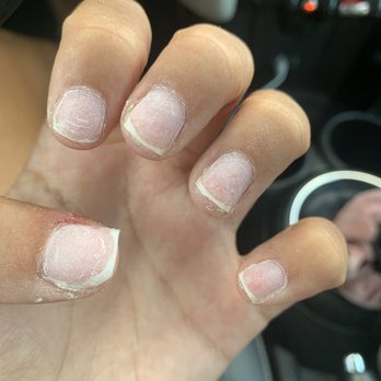 Circle A Nails And Spa - this is how I left, many layers peeled off my nails. Jagged edges. And bleeding. - Nail Salons Near Me - Redlands, California
